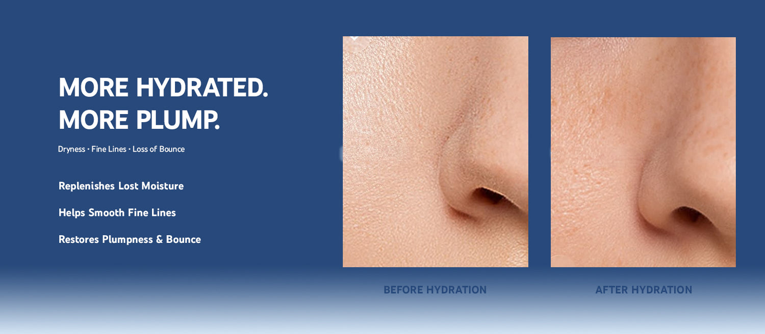 Hyaluronic Acid Solution 4