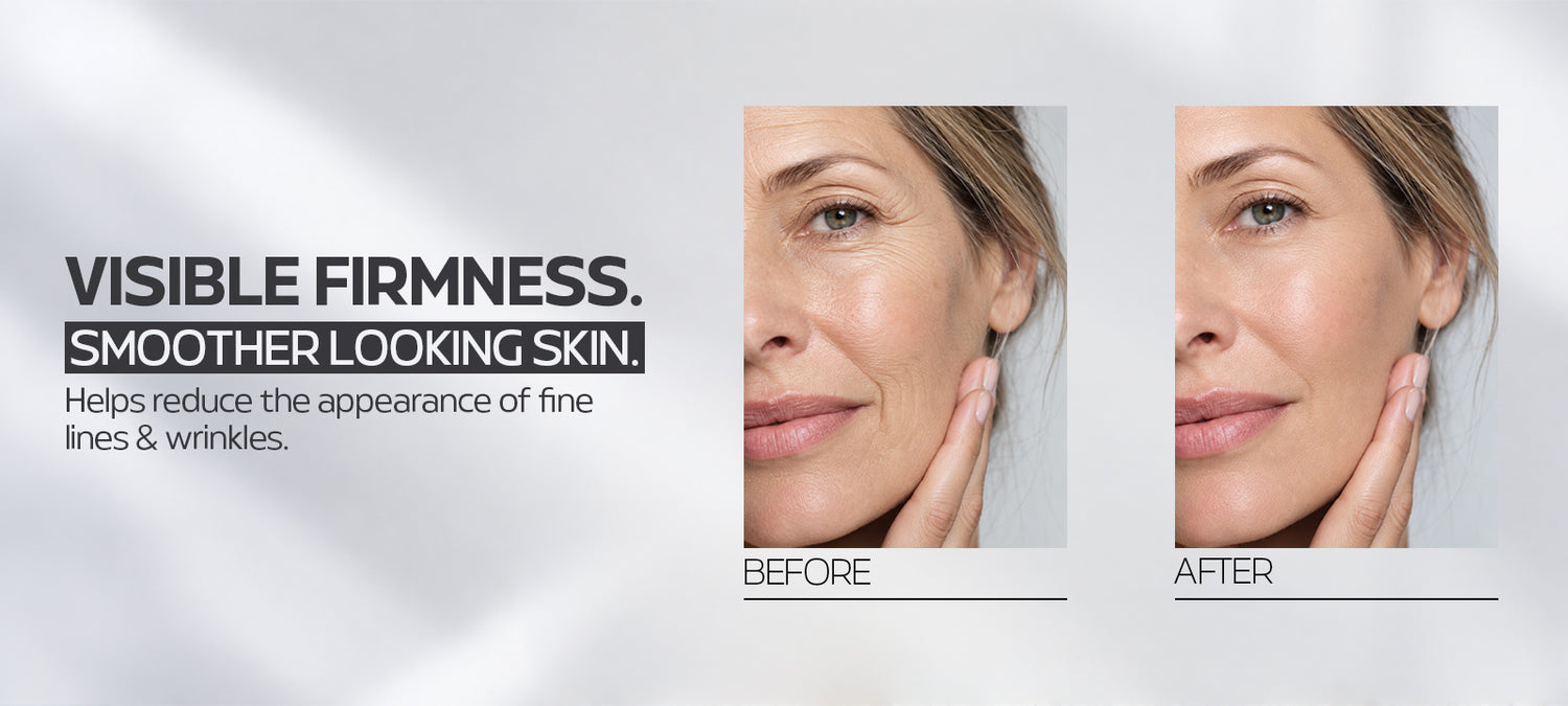 Anti Wrinkle Cream 3